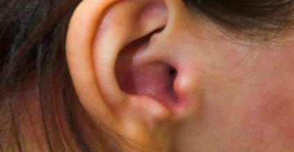 Cum să scoateți din ureche un obiect străin
