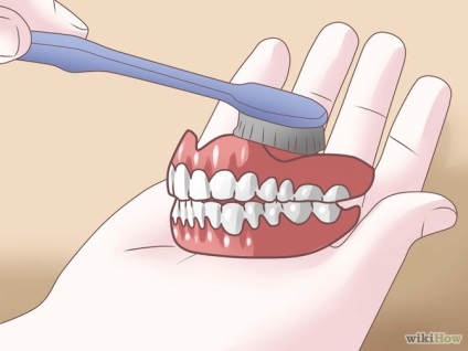 Hogyan előzhető meg a foltok a fogsor 1