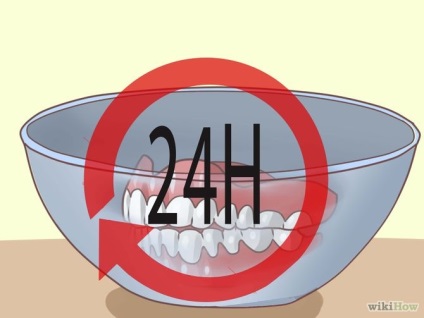Hogyan előzhető meg a foltok a fogsor 1