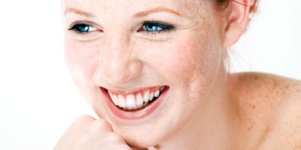Hogyan kell eltávolítani a pigmentfoltokat az arcon a zúzódás után