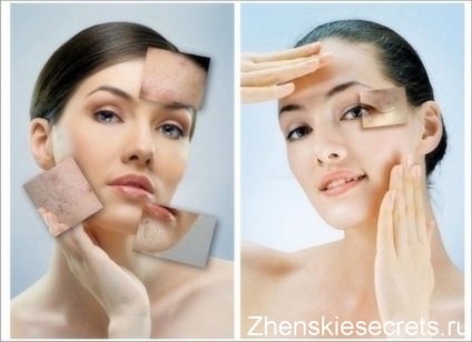 Cum să eliminați pete de pigment pe față după vânătăi