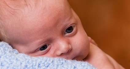 Conjunctivită la nou-născuți - cauze, simptome, tratament