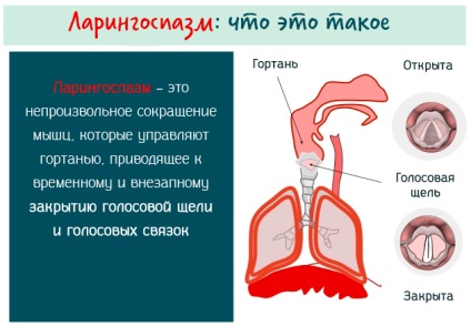 Laryngospasmus gyermekek és felnőttek - hogyan kell harcolni