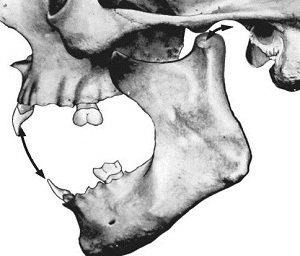 Mastiografie în stomatologie - un studiu al biomecanicii mișcărilor maxilarului inferior