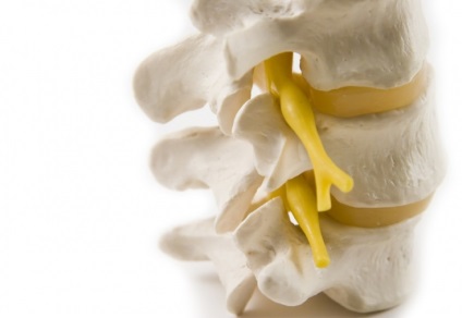 Metoda de evminov în bolile coloanei vertebrale