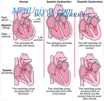 Mecanismele insuficienței cardiace congestive