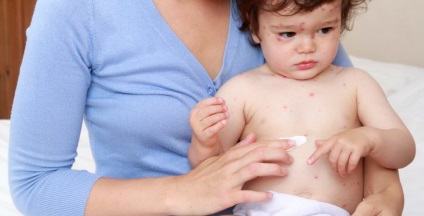 Este posibil să umbli un copil cu varicela