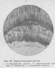 Pathohistologia cariilor dentare, stomatologiei terapeutice