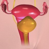 Obstetrica obstetrica ca acesta este un bisturiu - un portal medical de informare si educatie