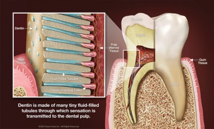 Hipersensibilitatea dinților (hiperestezie a țesuturilor dentare)