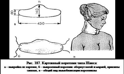 Bandaje pentru fractura coloanei vertebrale cervicale