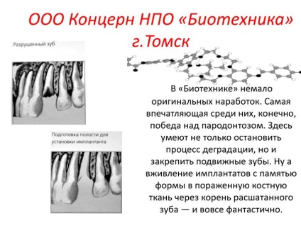 Ppt - nanotehnologia în prezentarea powerpoint în stomatologie