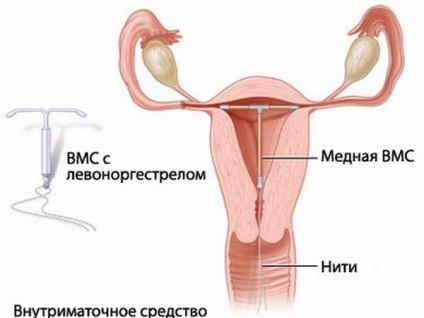 Cauzele sângelui stacojiu în menstruație