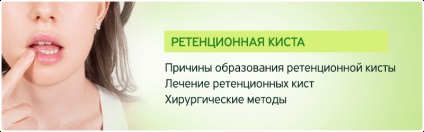 Megőrzési ciszta ajkak - kezelés megtartása ciszták Moszkvában