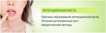 Задържане киста на устните - кисти задържане на лечение в Москва