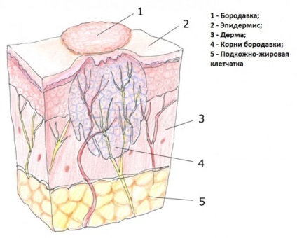 Structura de negi este un negru într-o secțiune