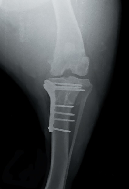 Tplo ca metodă de tratament a ligamentului cruciat anterior