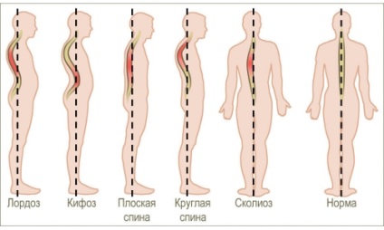 Exerciții pe bord-prevenitor al misiunii Yevmin, contraindicații, eficacitate