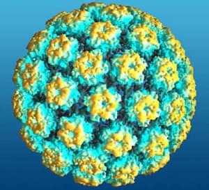 HPV și tratamentul eroziunii cervicale