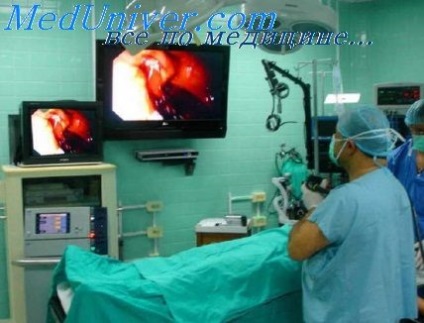Ultrasunete laparoscopice auxiliare