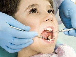 Alternativă la argintarea dinților copilului