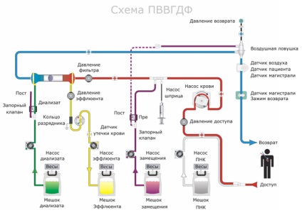 Aparatură pentru corecția extracorporeală a homeostaziei prismaflex