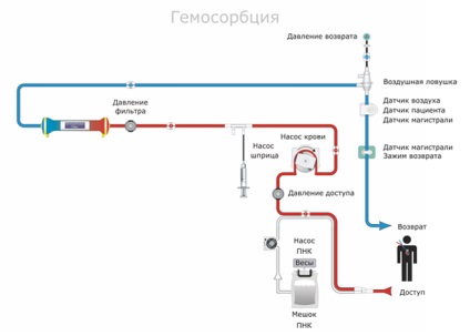 Aparatură pentru corecția extracorporeală a homeostaziei prismaflex