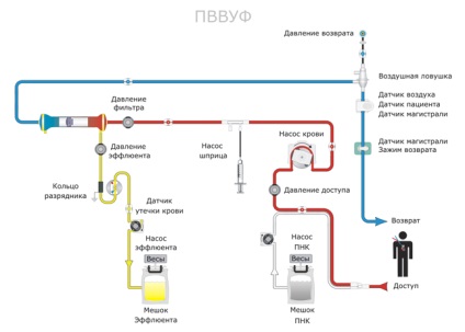 Aparatură pentru corecția extracorporeală a homeostaziei prismaflex