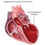 Aritmia cardiacă provoacă, simptome, tratament