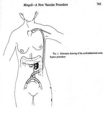 Reconstrucții arteriale