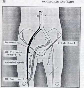 Reconstrucții arteriale