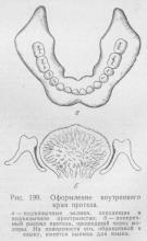 Metode biomecanice, stomatologie ortopedică