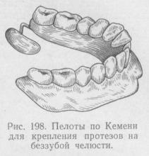 Metode biomecanice, stomatologie ortopedică