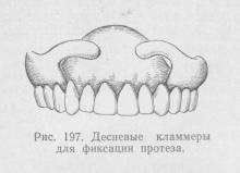 Metode biomecanice, stomatologie ortopedică