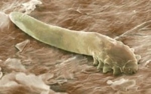 Cum să scapi de acarieni Demodex