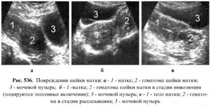 Diagnosticul bolilor uterului uterin