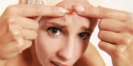 Uleiuri esențiale din acnee și acnee