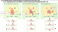 Electrocardiograma (eq)