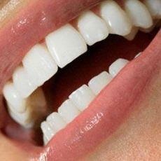 Az elülső fogak esztétikai helyreállítása - terápia - fogászati ​​hírek és cikkek -