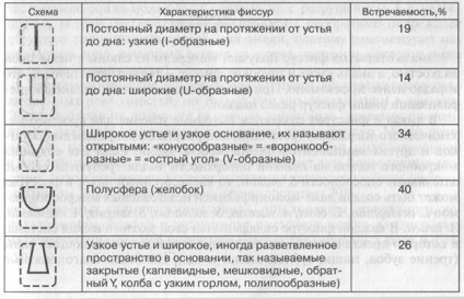 Etanșarea carierelor și a fisurilor dinților în prevenirea cariilor dentare