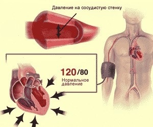 Clasificarea bolilor hipertensive și ce etape există