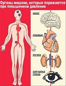 Clasificarea bolilor hipertensive și ce etape există