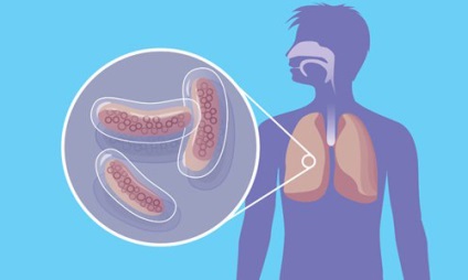 Ce tuse este observată în cazul tuberculozei pulmonare la copii și adulți