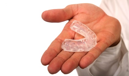 Kapa pentru dinti de nivelare - bretele transparente (invizibile) - pret in 32dent