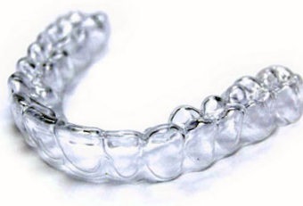 Kapa pentru dinti de nivelare - bretele transparente (invizibile) - pret in 32dent