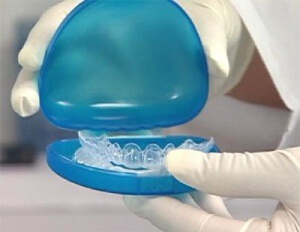 Kapy pentru tipurile de aliniere a dinților, materiale de fabricație, utilizare