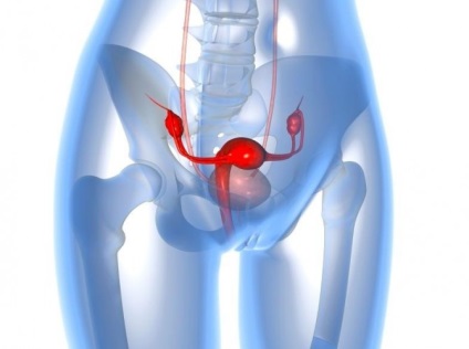 Chistul ovarian poate fi uneori o tumoare malignă a ovarului