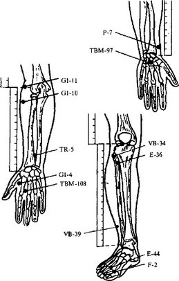 Nevralgia nervului trigeminal