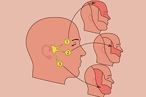 Nevralgia simptomelor nervului trigeminal, semne