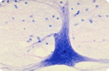 Neuronii cresc mult ca rădăcinile, știri despre medicamente pe eurolab